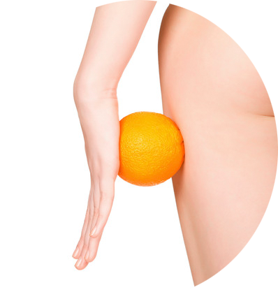 Resultados Thermage Tratamiento